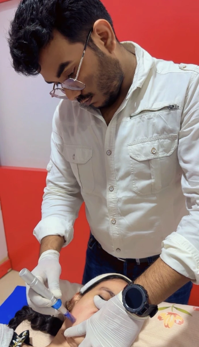 Microneedling treatment for acne scars in Raebareli