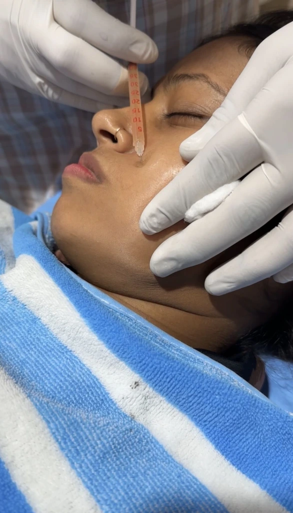 Dr Usama Siddiqui examining acne scars at Korean Skin Clinic