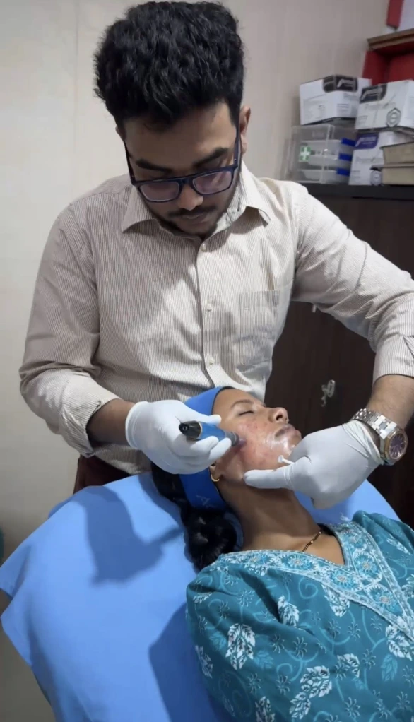 Melasma treatment in Raebareli by Dr Usama Siddiqui