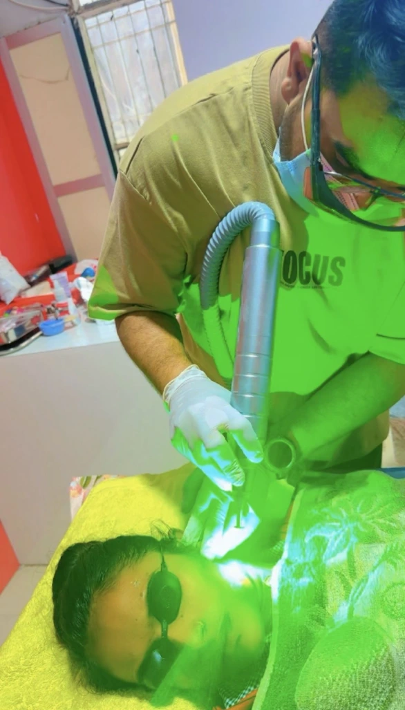 Pico Laser for Melasma