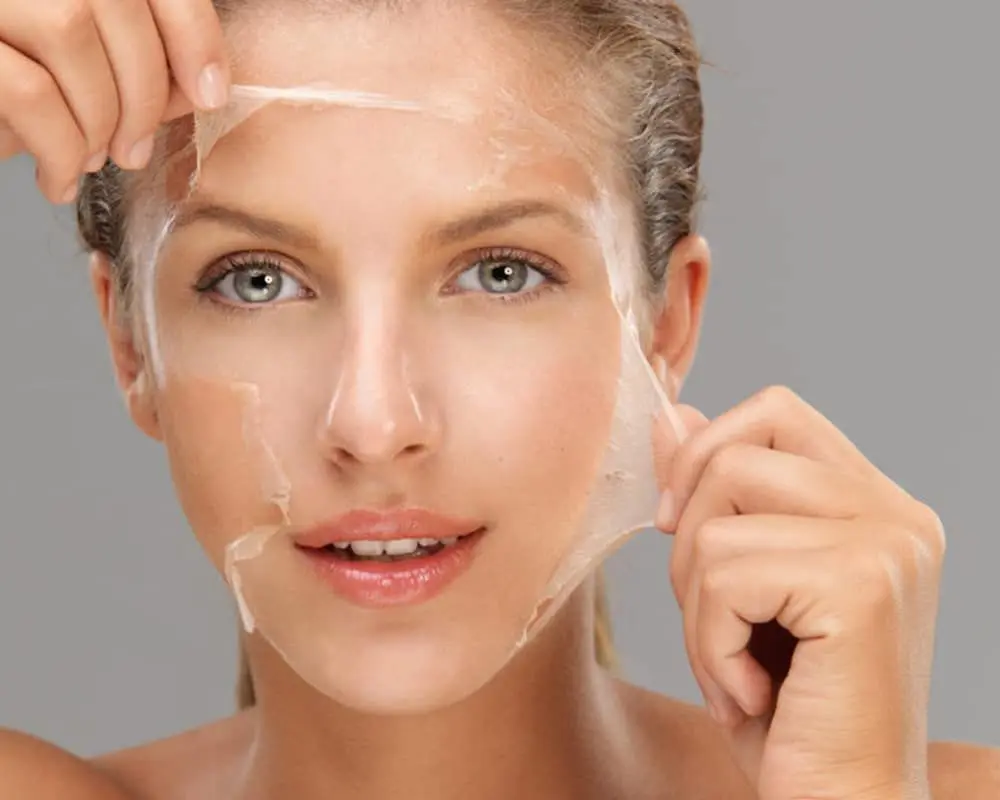 Chemical Peels