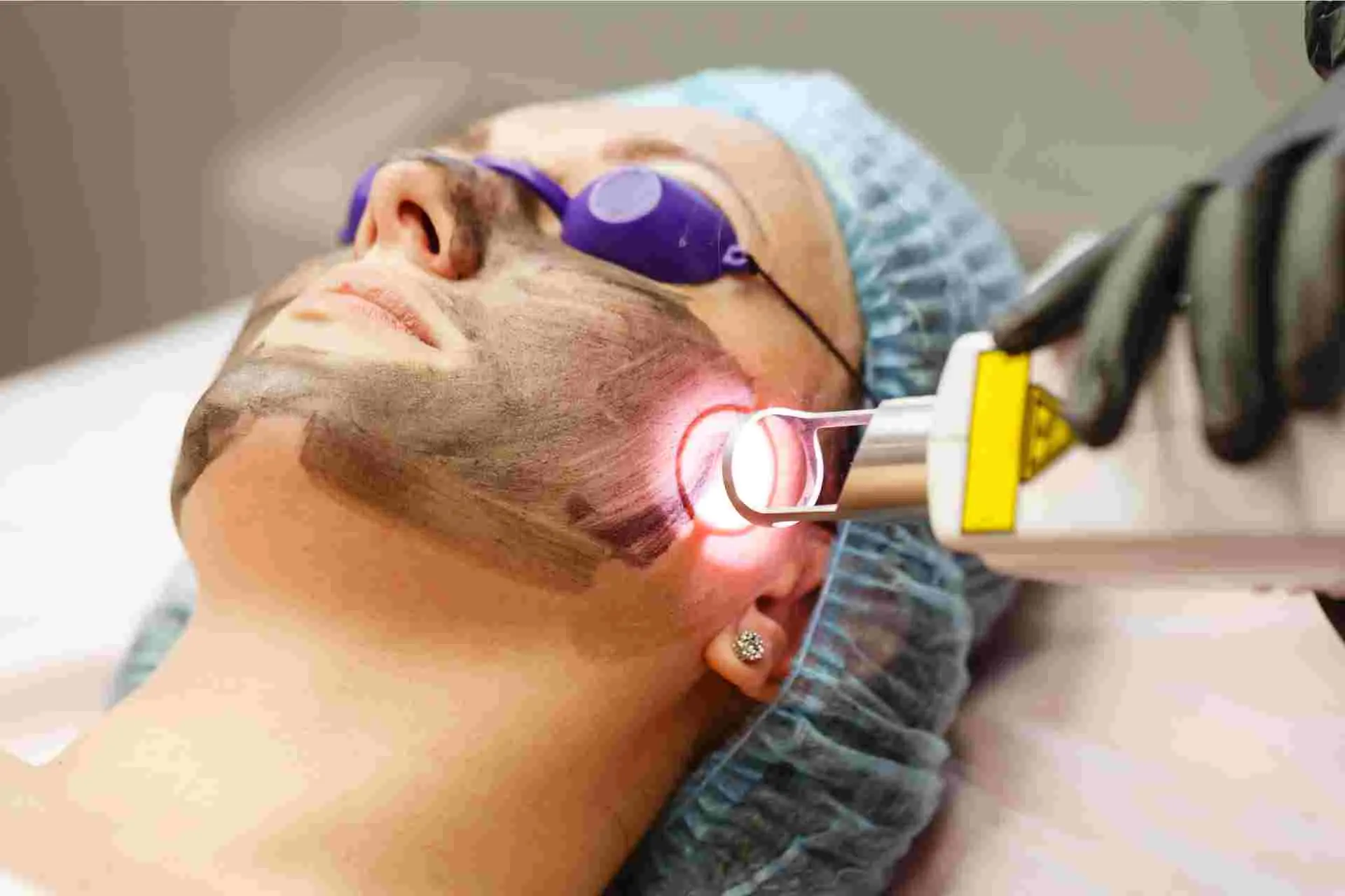 Hollywood Facial